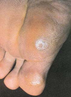 ����������� ���������