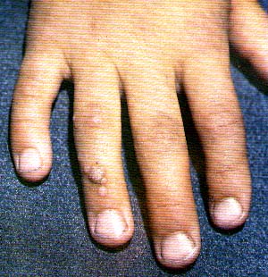 ���������� (�������) ���������